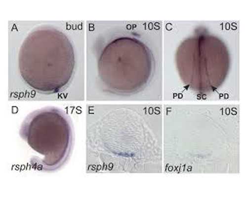 子宫内膜增生做试管婴儿吗