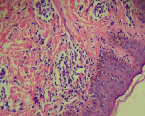 正规捐卵机构-卵泡多大才成熟