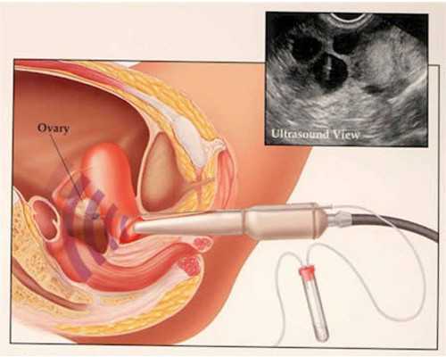 孩子在家表现简短评语（家长评语给孩子爱的鼓励） 试管婴儿机构 代孕