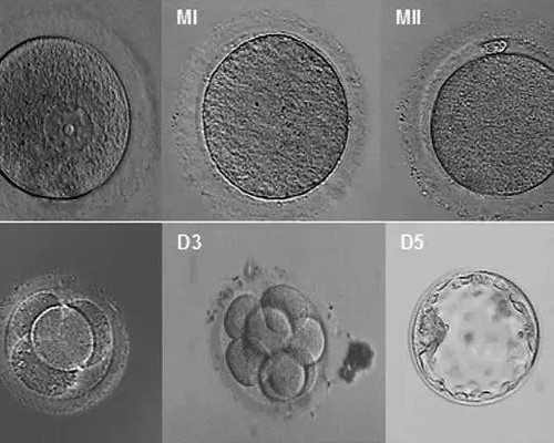 怀孕六个月反胃想吐，怀孕六个月顶胃咋回事？