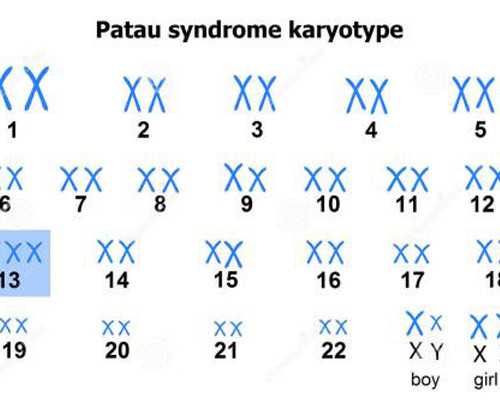卵巢囊肿影响做试管吗男性？卵巢囊肿是否影响试管婴儿