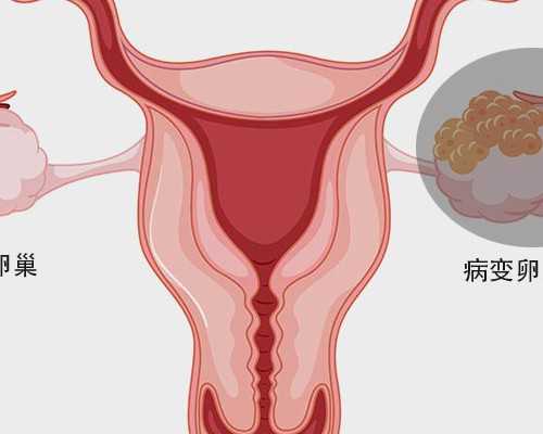 泰国医院试管婴儿费用报价是多少(十五万够不) 哪里有代生试管