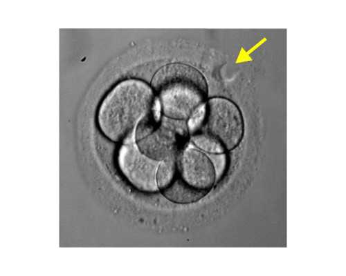 卵巢功能下降了还可以做试管吗 卵巢功能下降能做试管婴儿吗
