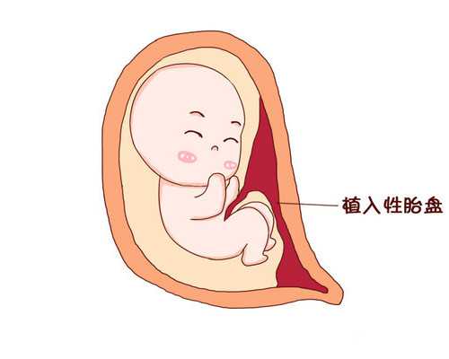 多囊卵巢怎么备孕才能成功？除了试管还有这2种方法 辅助代孕公司