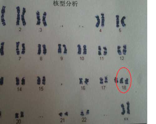 四维彩超攻略分享，当天预约即刻检查 供卵代怀选性别的医院